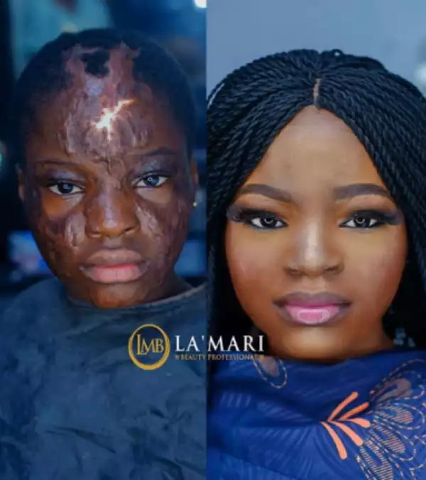 Shocking Makeup Transformation Of A Lady Who’s Face Is Disfigured After Fire Accident (Photos)
